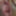 Closeup of my squirting prolapse pussy and a fucked urethral #12