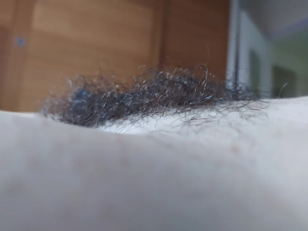 hairy #18