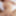 Teaser