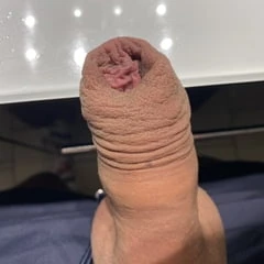 Loose foreskin porn