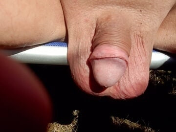Scrotum becomes long #13