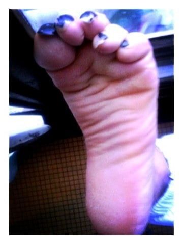 Asian ts feets, soles, toenails mix #4