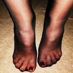 Only Hold-Up Nylons