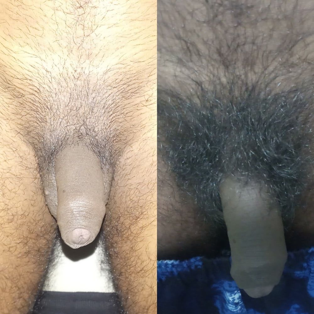 Shaved penis hair