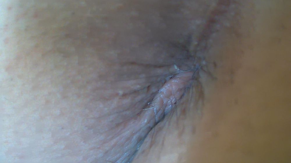 My hole