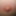 Suction #6