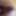 Anal Gaping aand Bedpost 