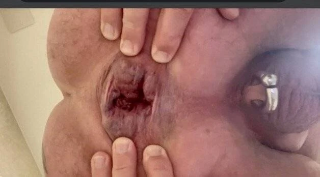 My Ass #3