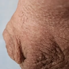 Micro Penis