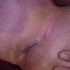 ตูดและรูที่น่ารักของกู