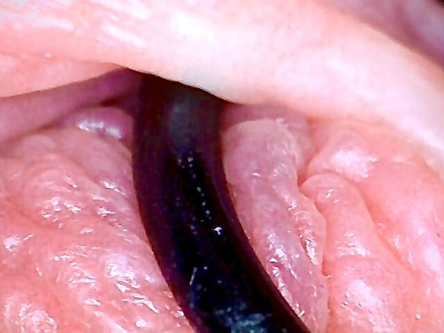 Saline Injection #35