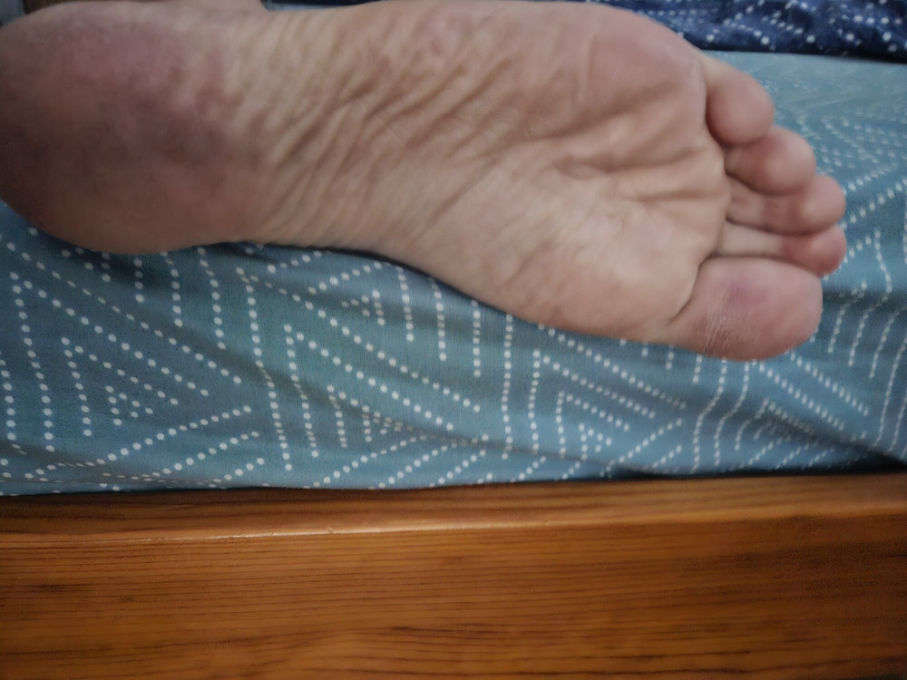 pieds #3