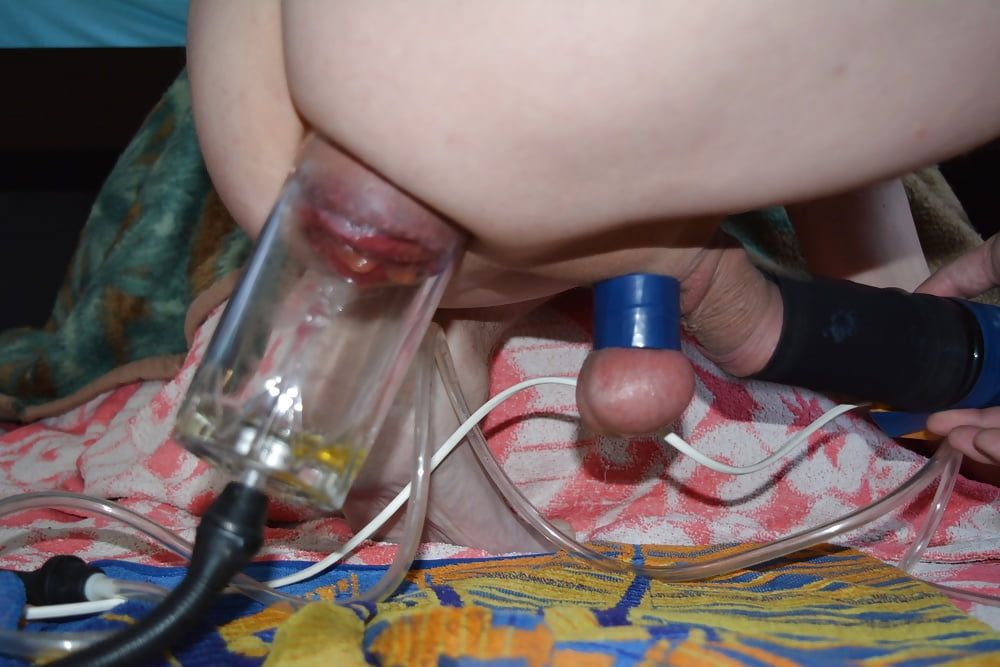 extreme prolapse pumping #33