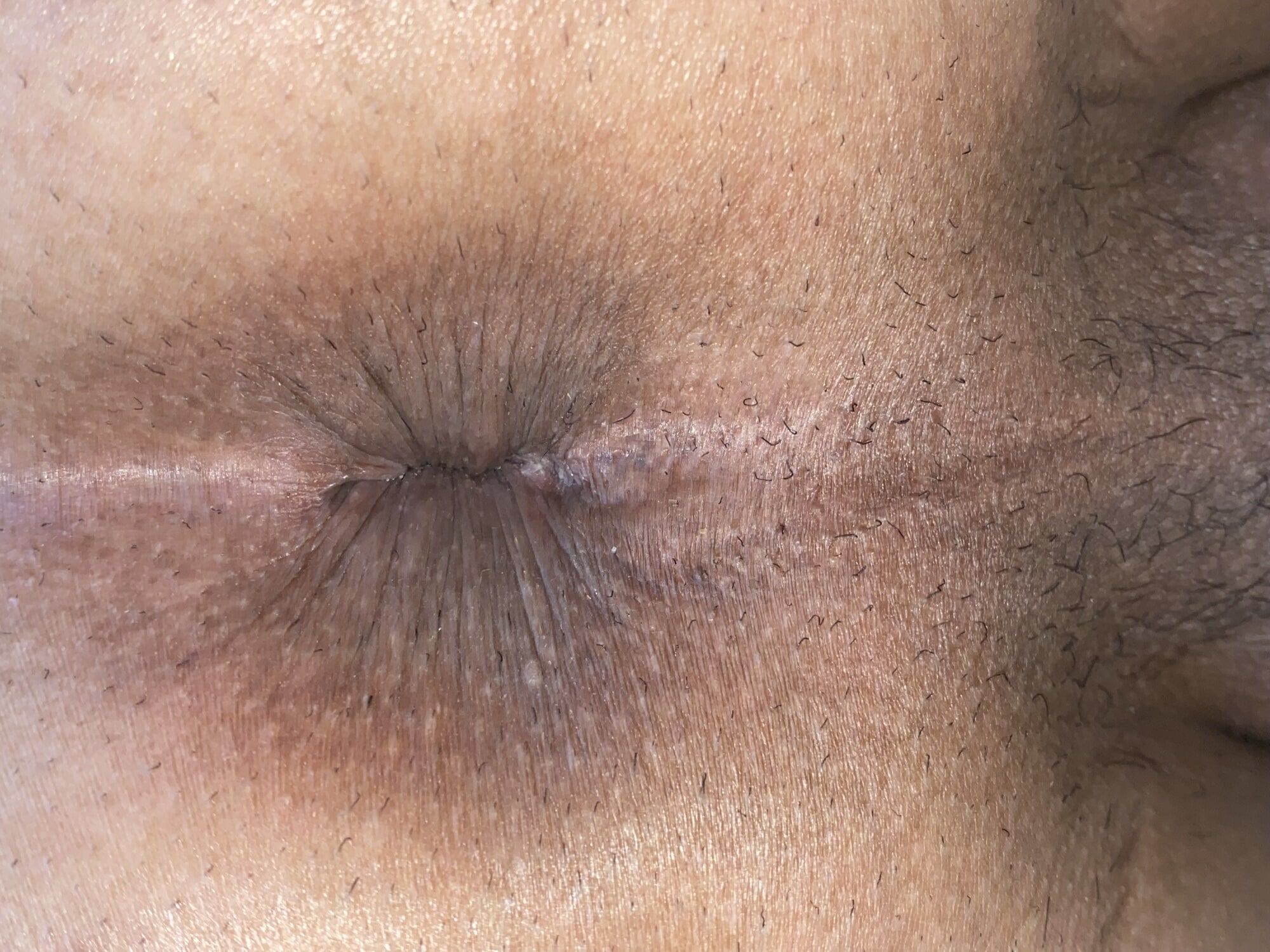 Close-up of a man's anus #57