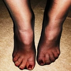 Only Hold-Up Nylons