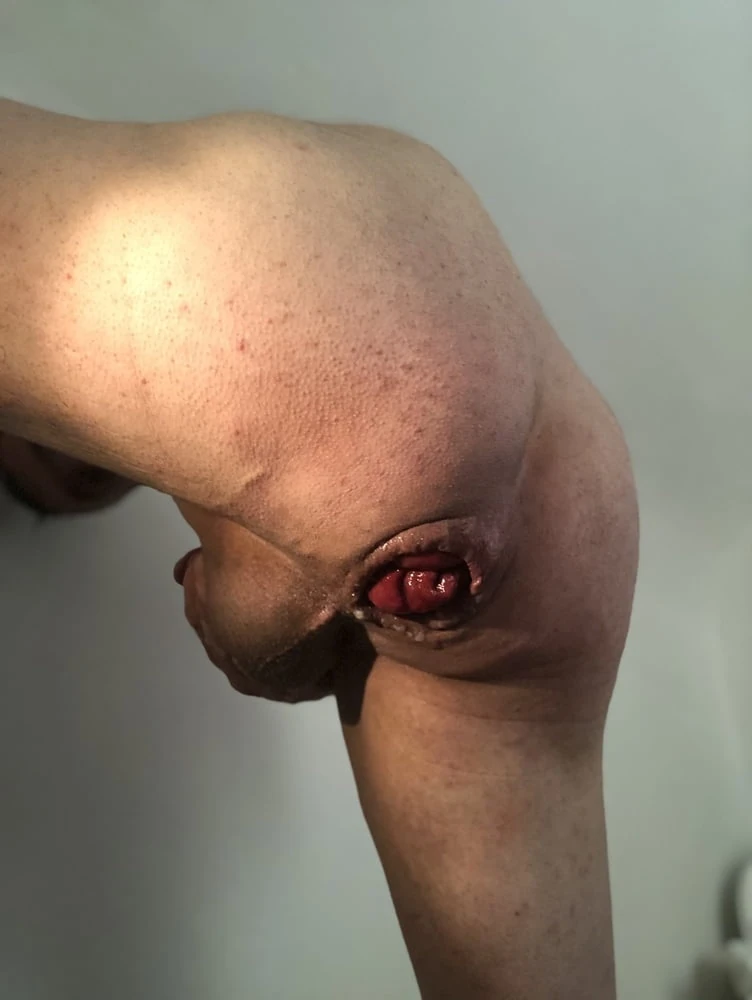 Gape anal #35