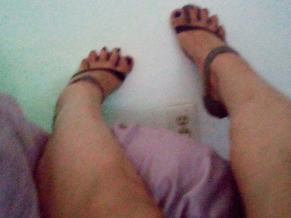 Overhanging toes, ankle straps, toe spreading.  #2