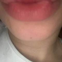 Kiss 