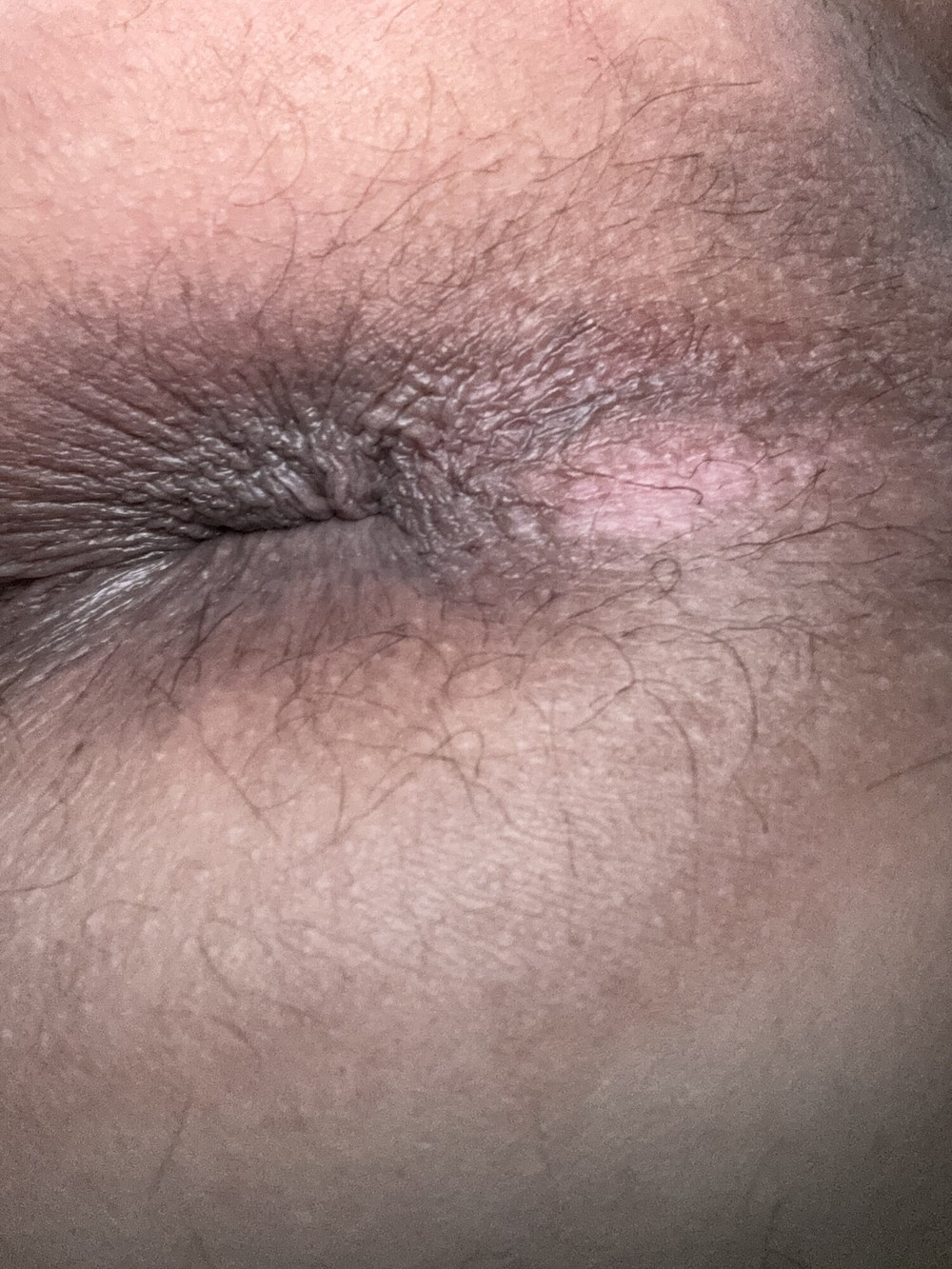 Can’t sleep