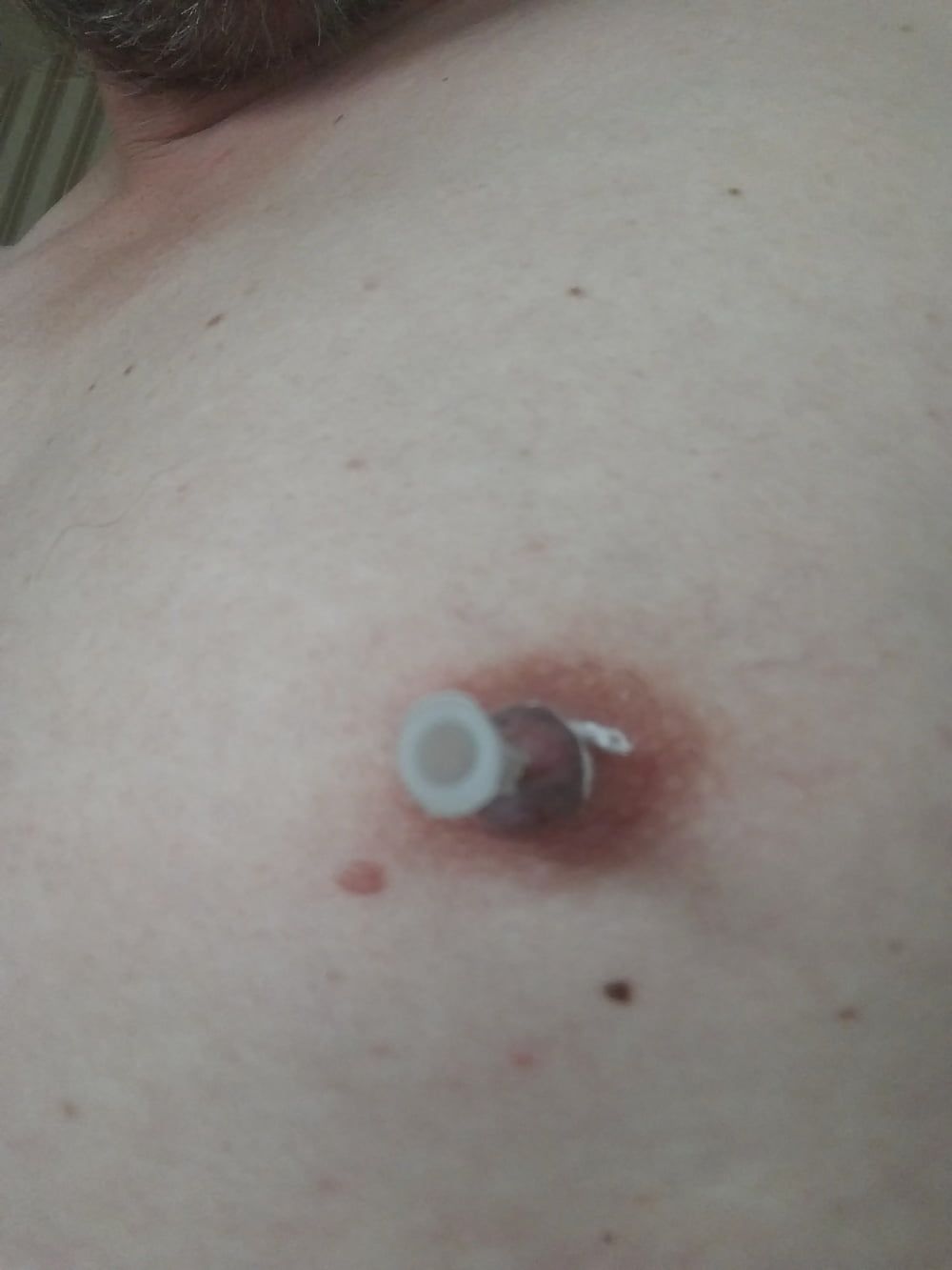 some more needles in my nipples #6