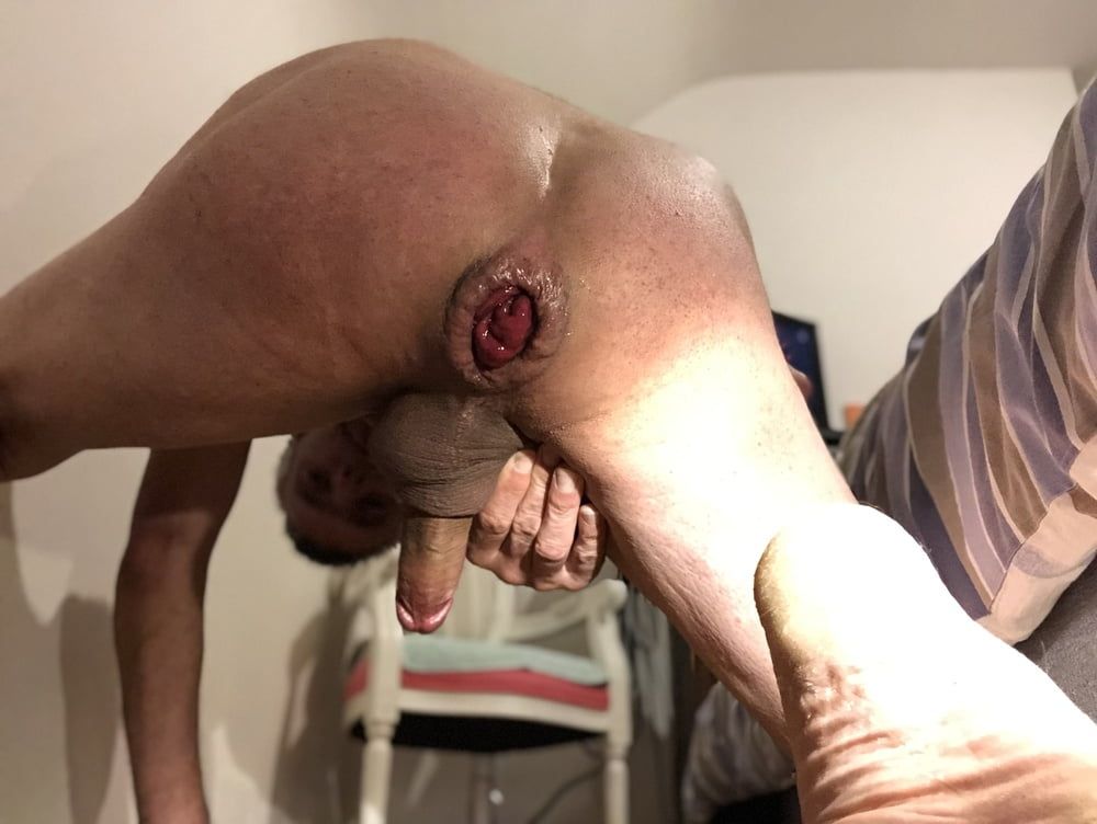 anal dilation photo shoot #7