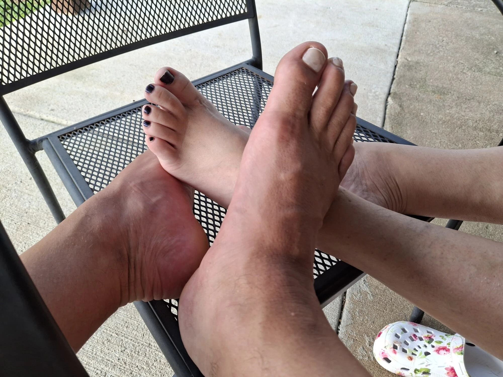 Foot comparison