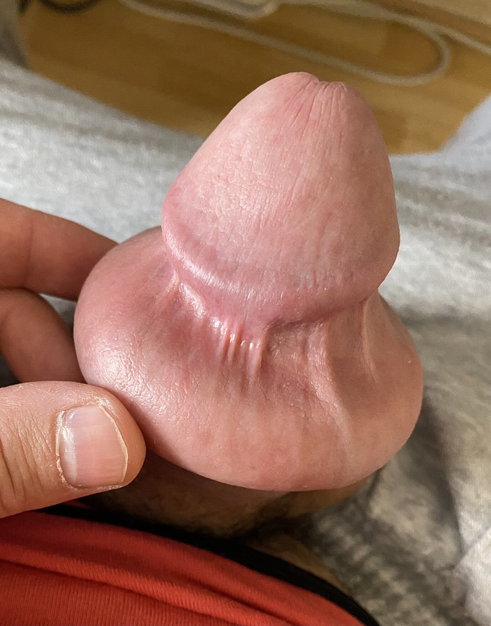 Foreskin extreme stretching porn