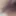 BBW meaty hairy pussy lips. Swollen clit. Huge labia.