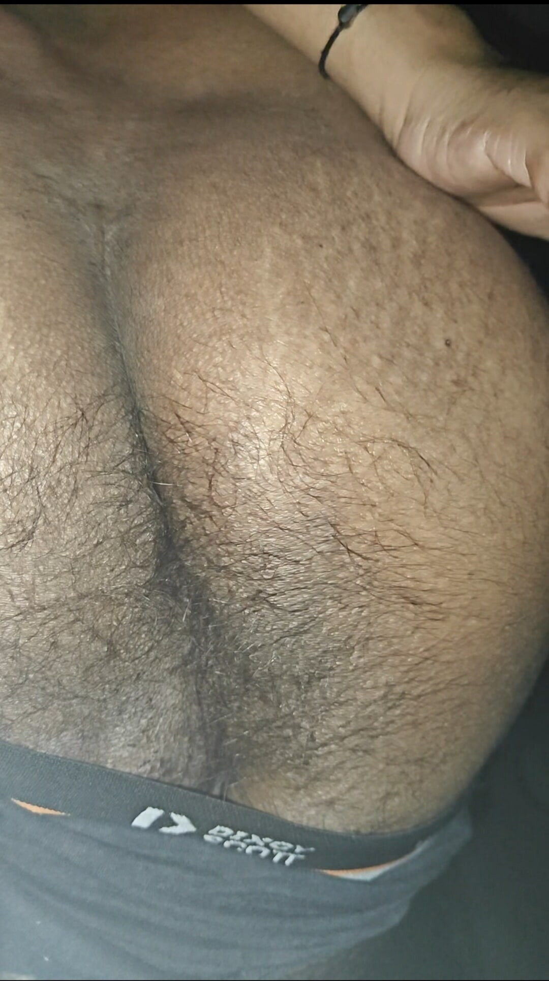 Asshole #9