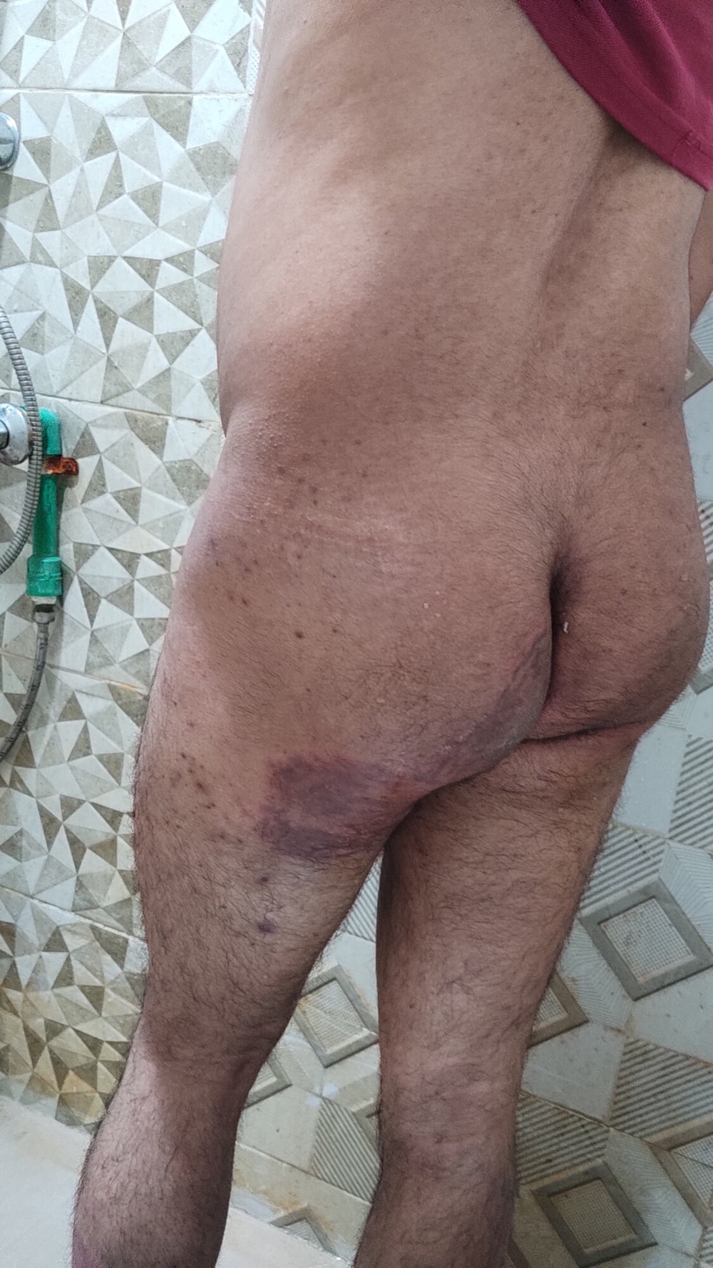 My Ass 