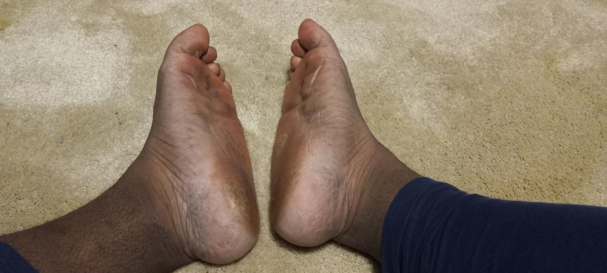 Pics of my Feet #19