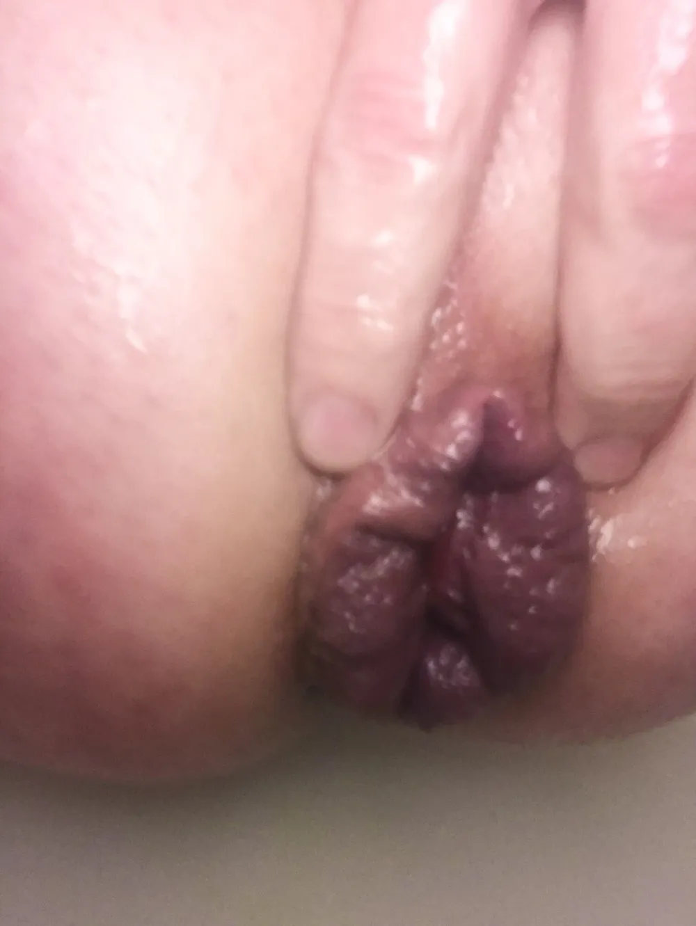 My prolapsing anus #39