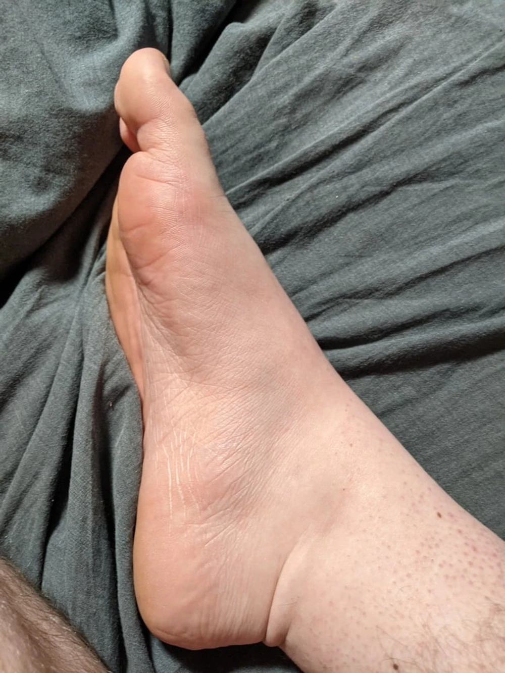 Feet Pictures #2 33 feet Pictures to cum on it  #2