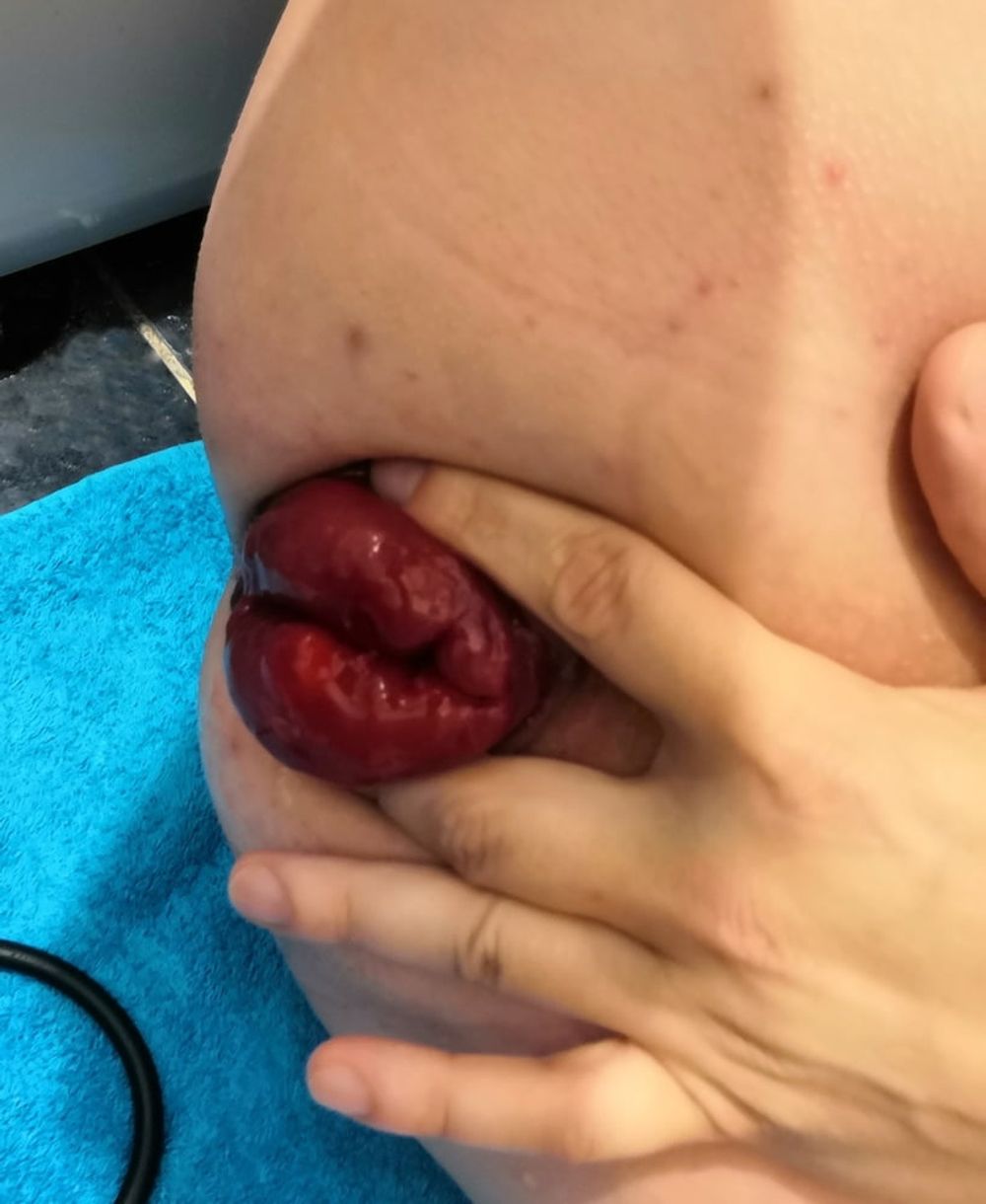 extreme prolapse pumping #10