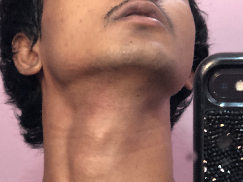 Pics of my slim  body  #17