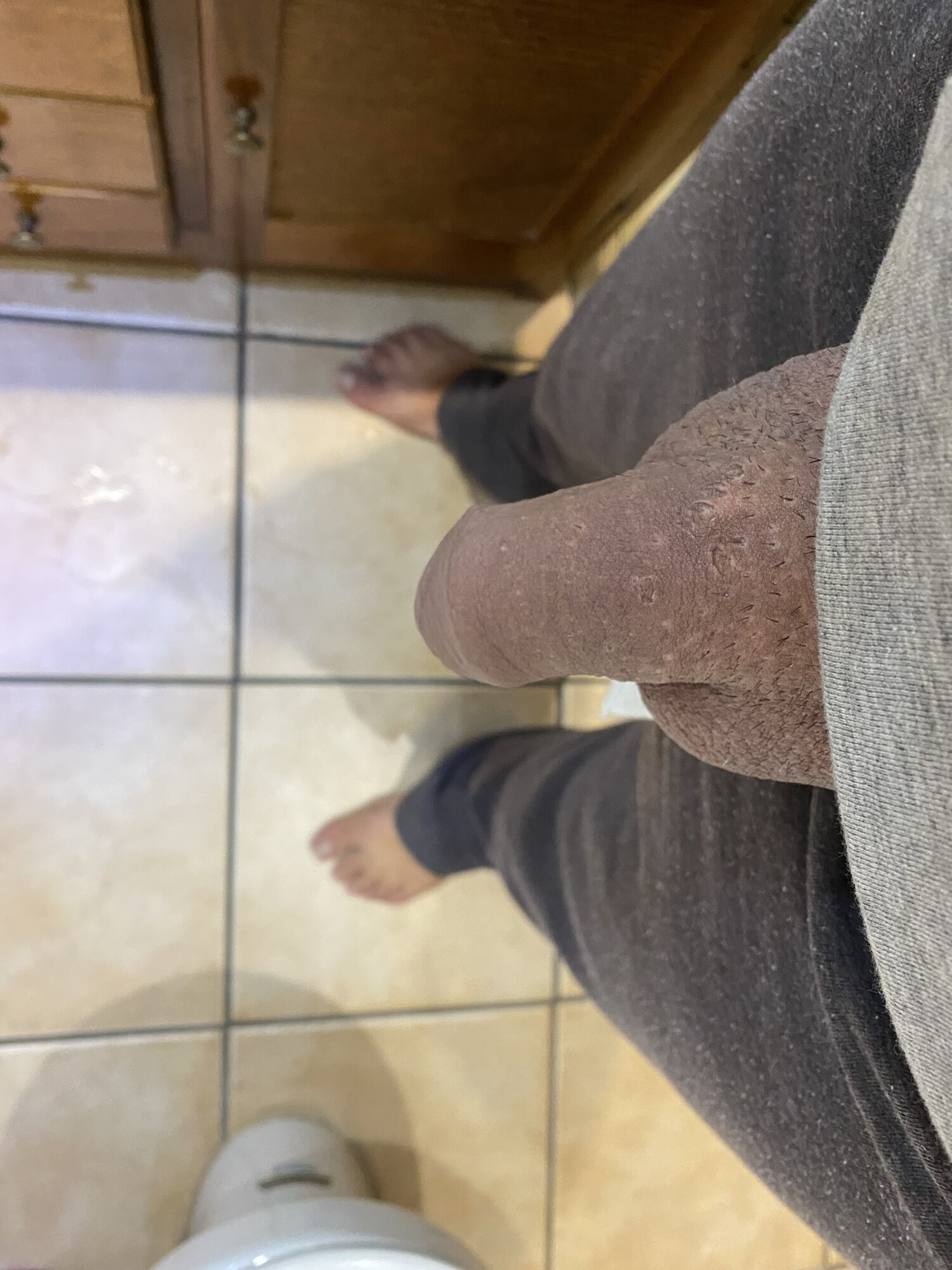 Yo1 #3