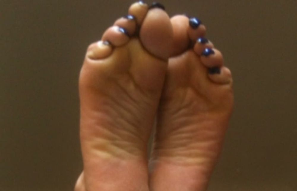 blue toenails and soles feet after day at beach  #37