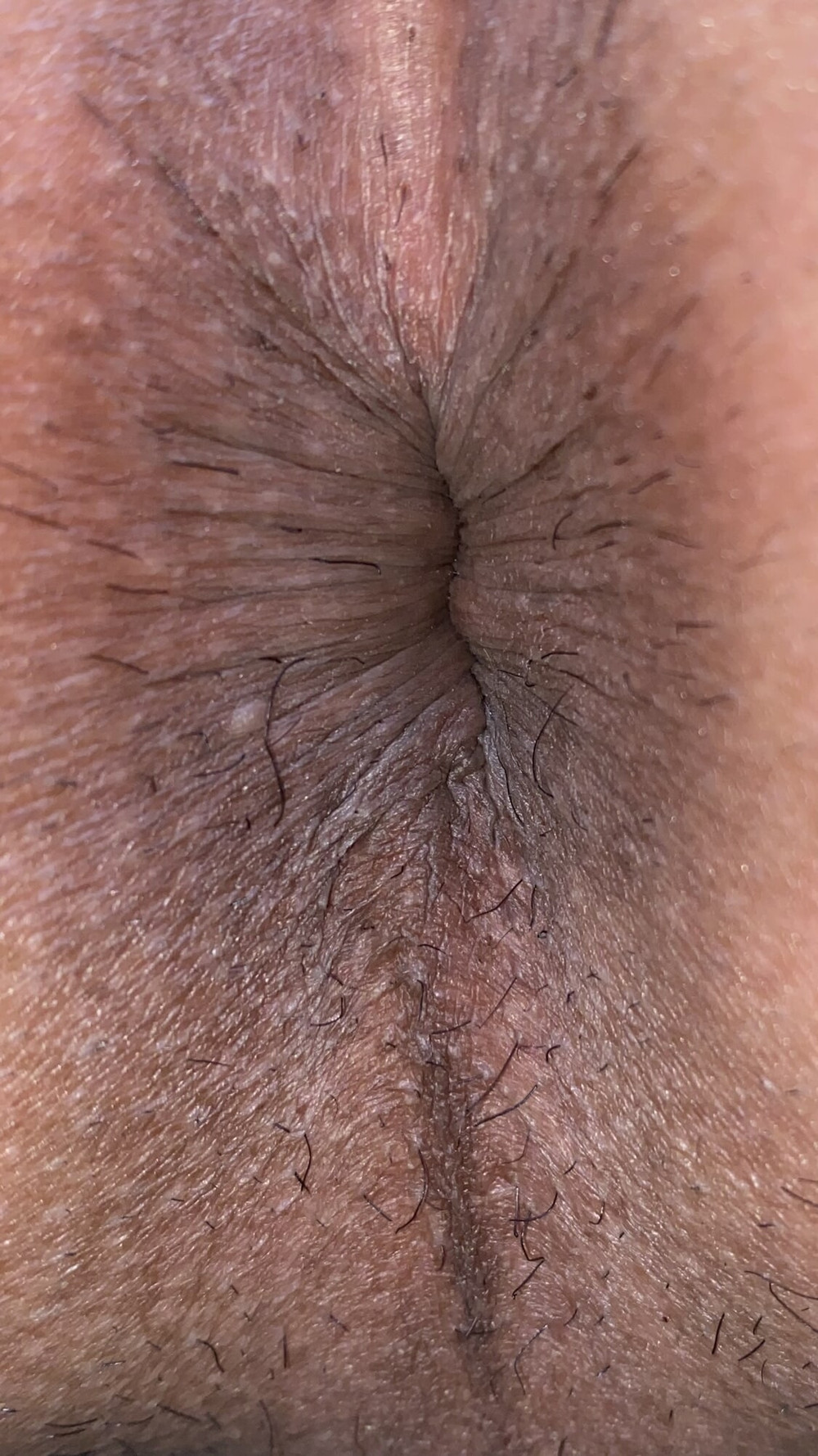 Close-up of a man&#039;s anus #22
