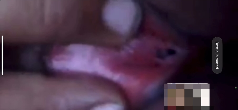 My gf pussy hole pics #2