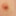 Gland #3