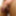 anal #10