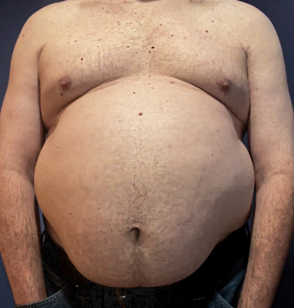 Ximd9000 Big Bloated Belly #3