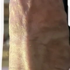 Morning wood