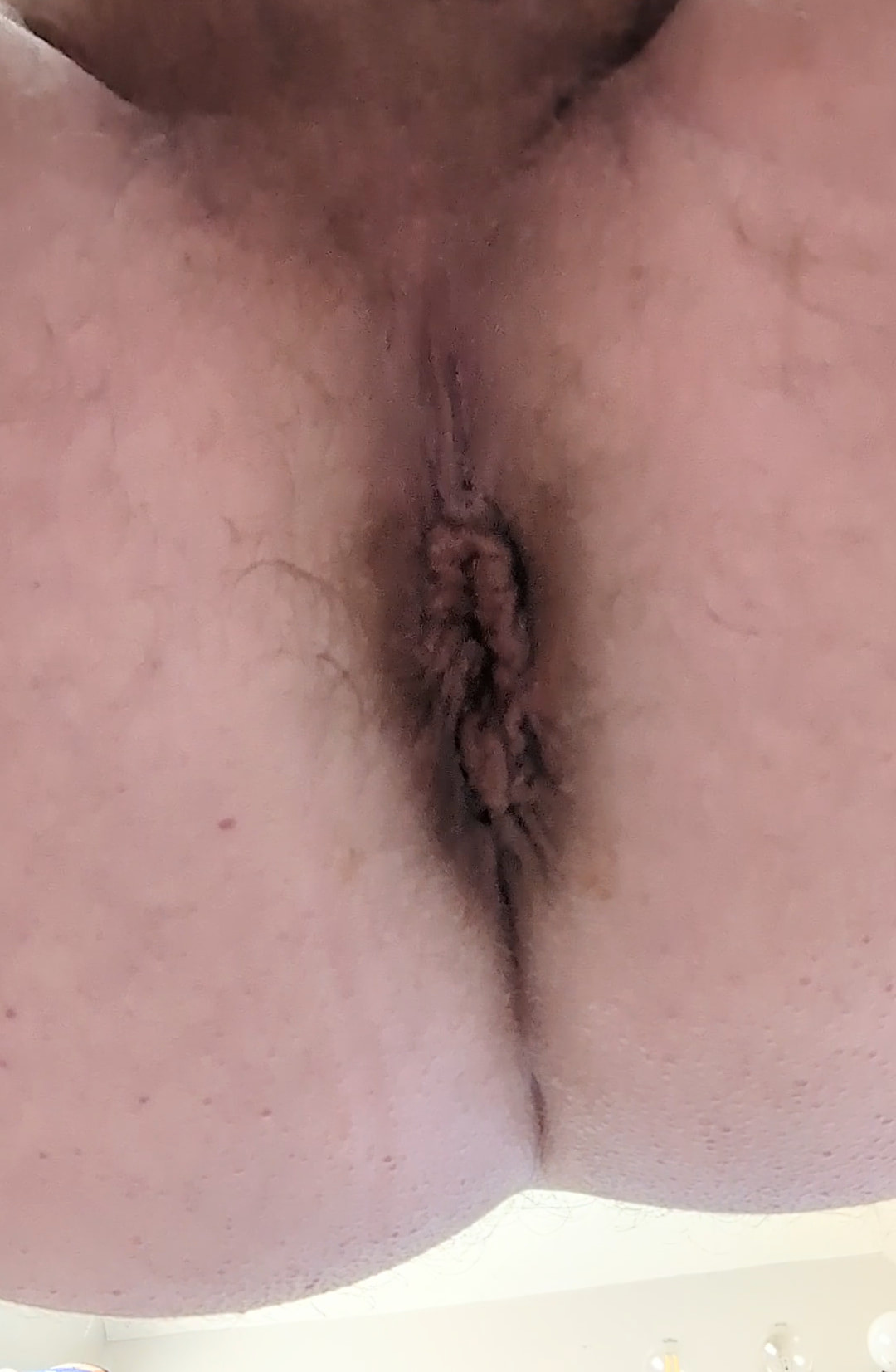 MY CLOSE UP HOLE