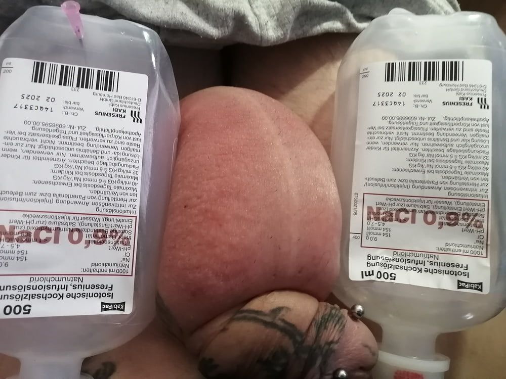 saline-infusion in scrotum first try 1 liter #19
