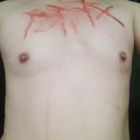 bondage