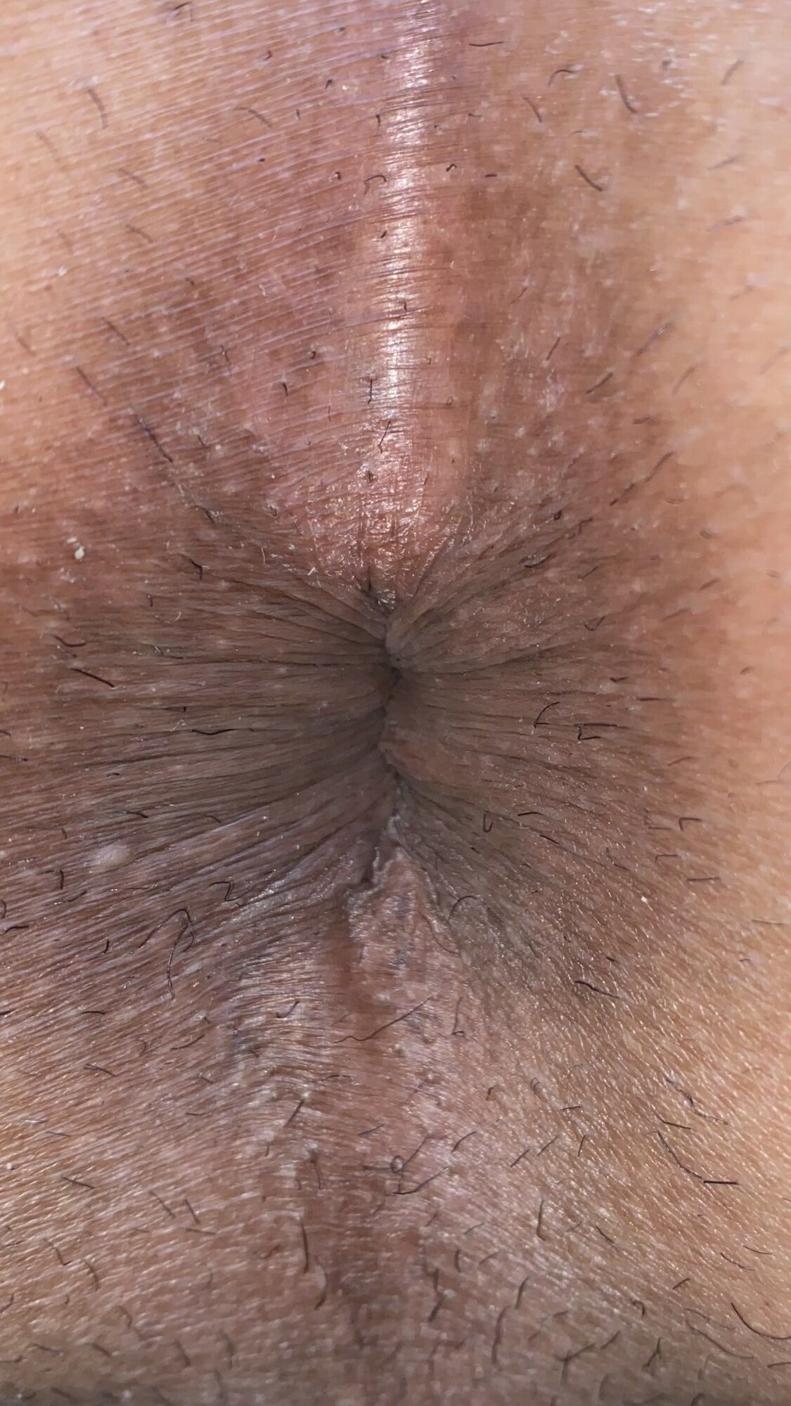 Close-up of a man's anus #8
