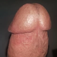 My Dick