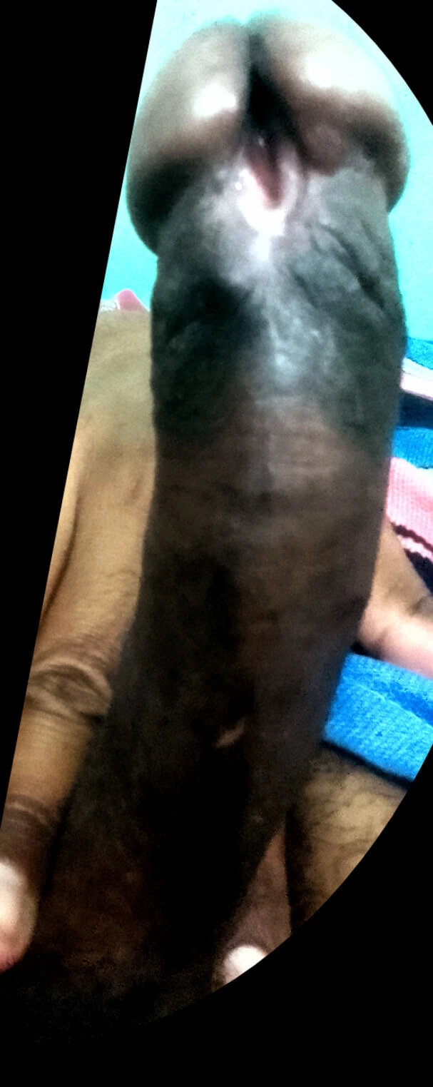 Subincision 