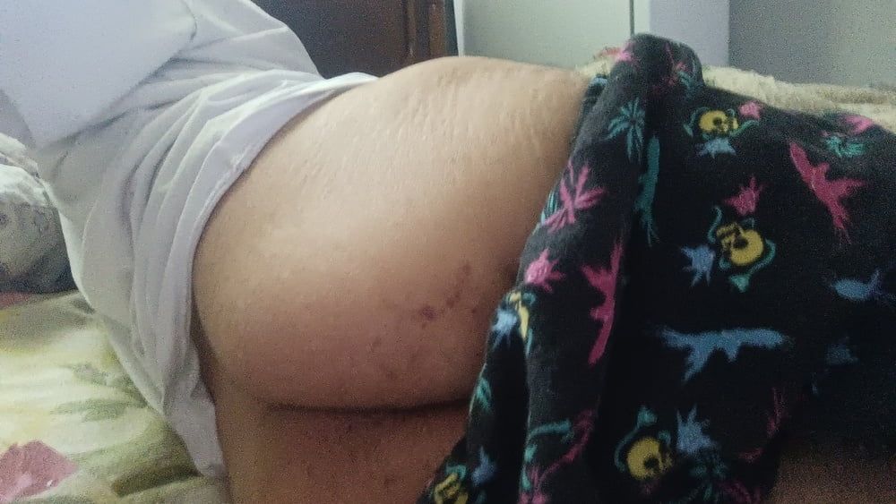 my dick and my ass ! disabled gay #2